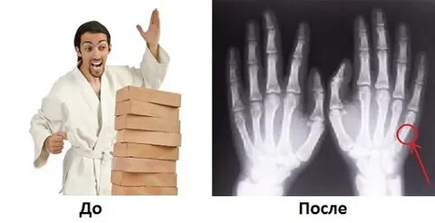 Как безболезненно сломать