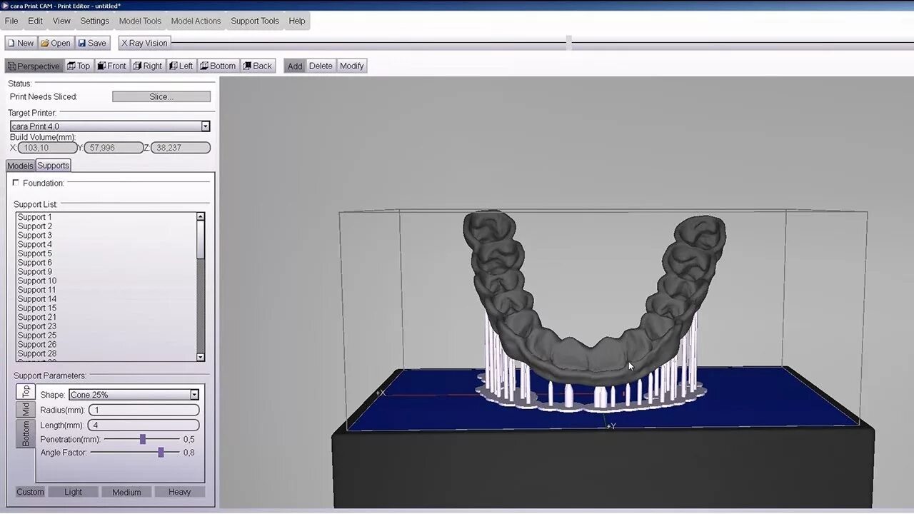 CAD cam 3d печать. 3д моделирование КАД Кам. CAD cam моделирование зубов. Моделирование вкладки в CAD cam. Ис кам