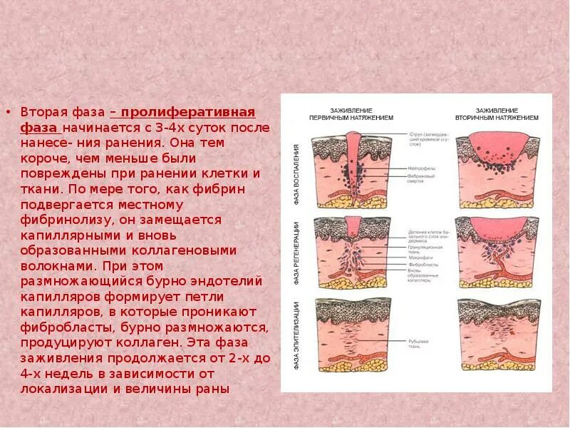 Через сколько заживает рана. Процесс заживления раны. Вторая фаза раневого процесса. Классификация РАН презентация.