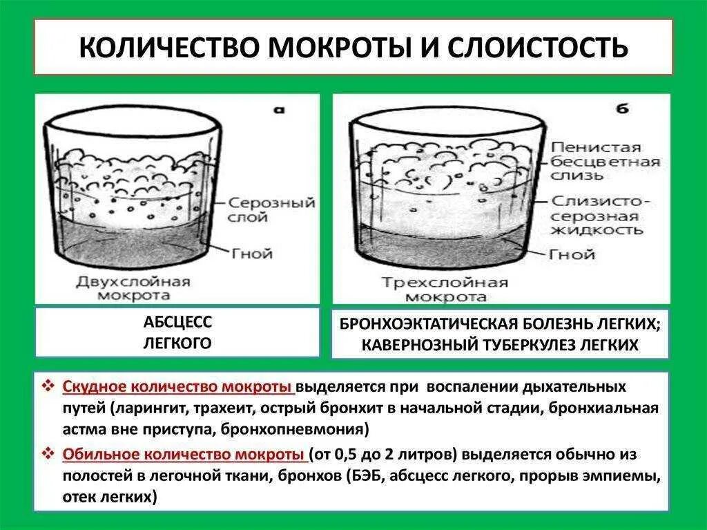 Почему у ребенка мокрота. Объем мокроты при абсцессе легкого. слои мокроты при бронхоэктатической болезни. мокрота при абсцессе легкого. мокрота при заболеваниях легких.
