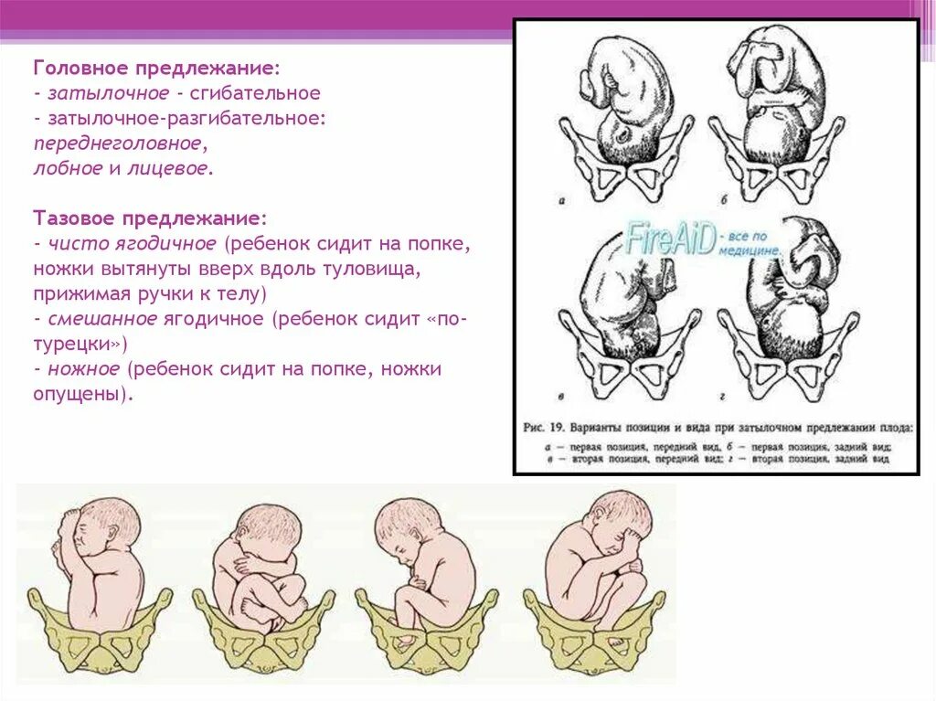 Самопроизвольное предлежание. Головное предлежание плода биомеханизмы. Тазовое предлежание плода биомеханизм родов. Лобное предлежание 1 позиция передний вид. Головное предлежание плода лицевое.