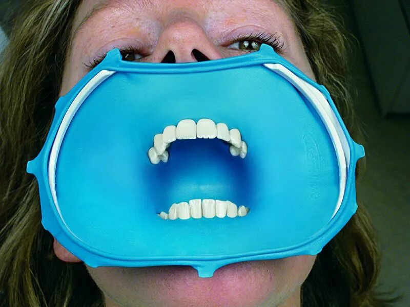 Во сколько открывают рот. Коффердам оптидам раббердам. Коффердам оптидам в стоматологии что это.