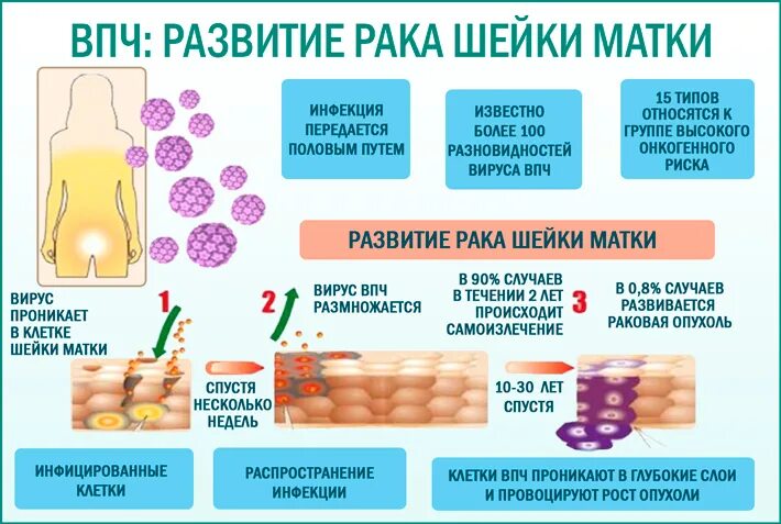 Прививка от рака шейки матки для девочек. Вирус папилломы человека (ВПЧ). Вирус папилломы человека вакцина. Вакцинация ВПЧ памятка.