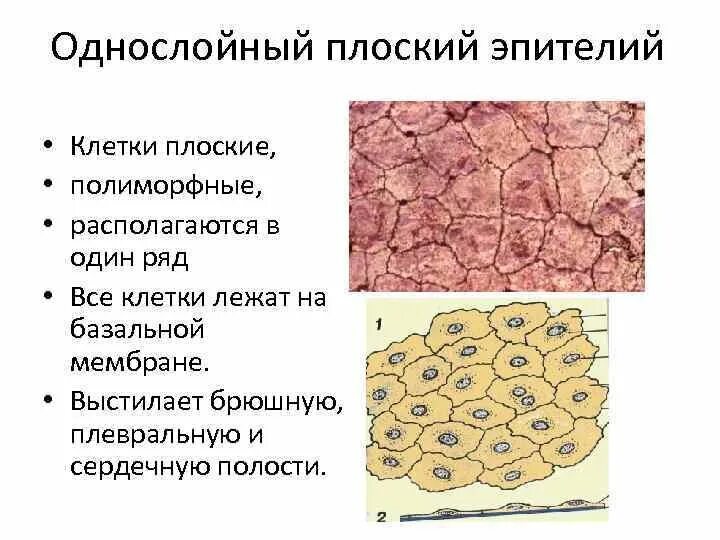 Клеткой плоской эпителии нерезко выраженные