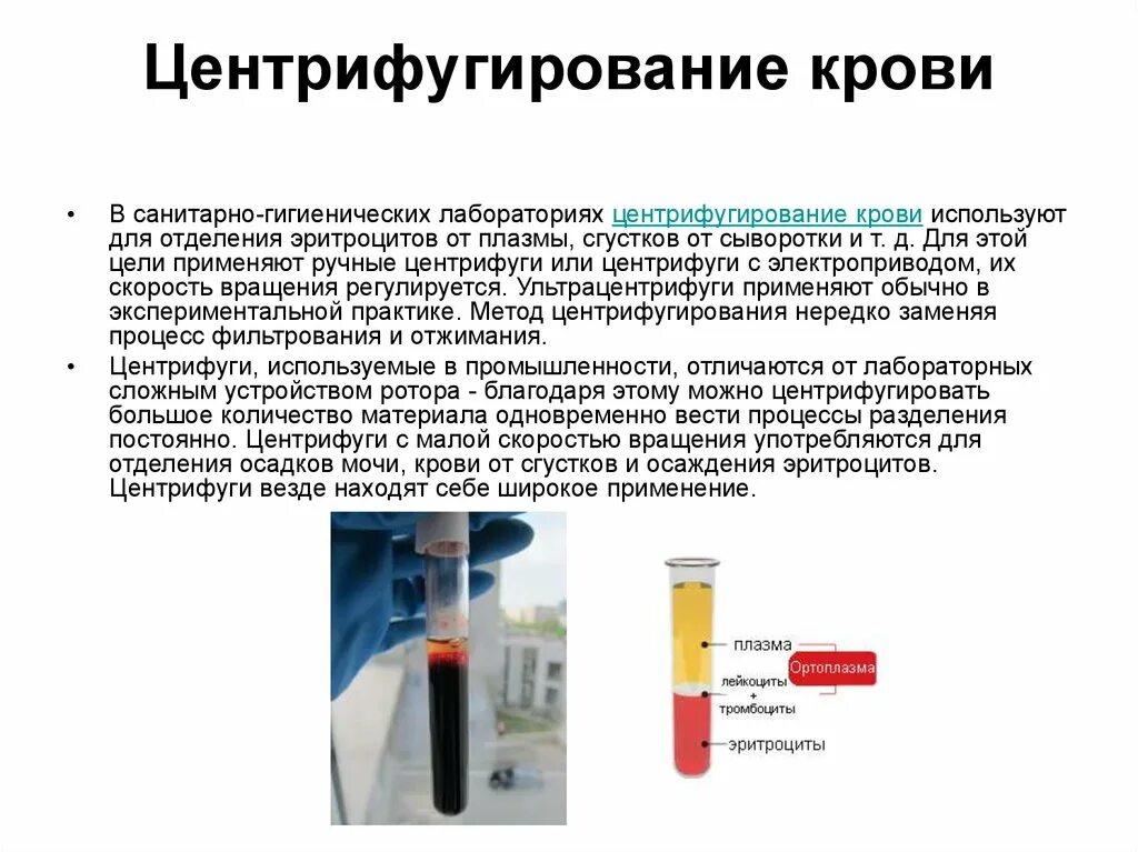 Как можно получить кровь. Центрифугирование крови алгоритм. Методика центрифугирования крови. Сыворотка и плазма крови центрифугирование. Как получить сыворотку крови центрифугирование.