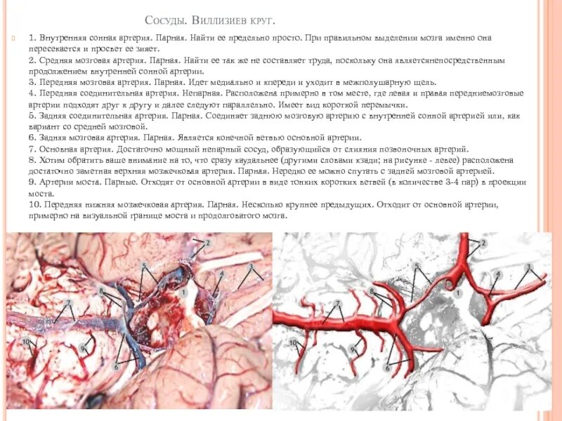 Правая задняя трифуркация. Сосуды головы Виллизиев круг. Внутренняя Сонная артерия Виллизиев круг. Артерии головного мозга анатомия Виллизиев круг.. Внутренняя Сонная артерия Визилиев круг.