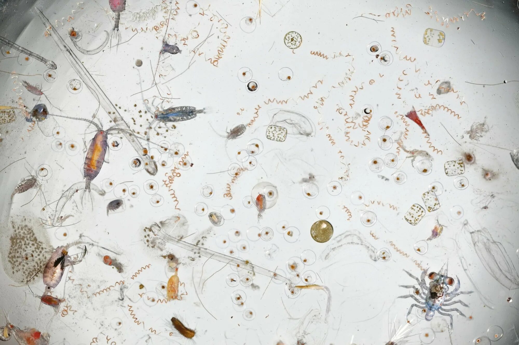 Бактерии в питьевой воде. Морская вода под микроскопом. Морская капля под микроскопом. Как выглядит морская вода под микроскопом. Капля морской воды под микроскопом.