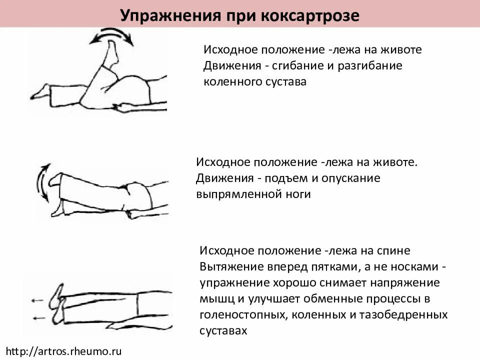 Какие упражнения при артрозе коленного сустава. Гимнастика для коленных суставов. Гимнастика при коксартрозе 1 степени. Комплекс упражнений для тазобедренного сустава лечебная гимнастика. Упражнения при коксартрозе тазобедренного сустава.