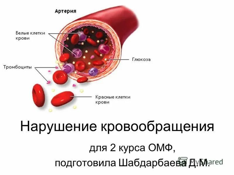 Нарушение кровообращения определение. Нарушение кровообращения определение
