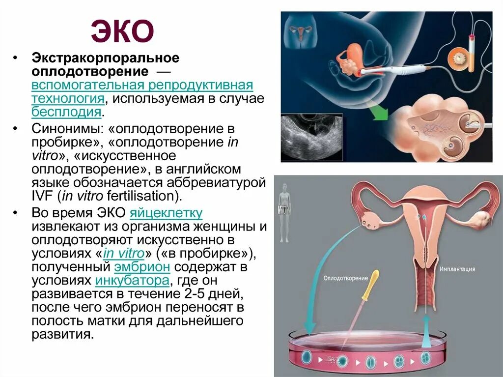 Экстракорпоральное оплодотворение. Эко экстракорпоральное оплодотворение. Эко это искусственное оплодотворение. Искусстсвенноеоплодотворение.