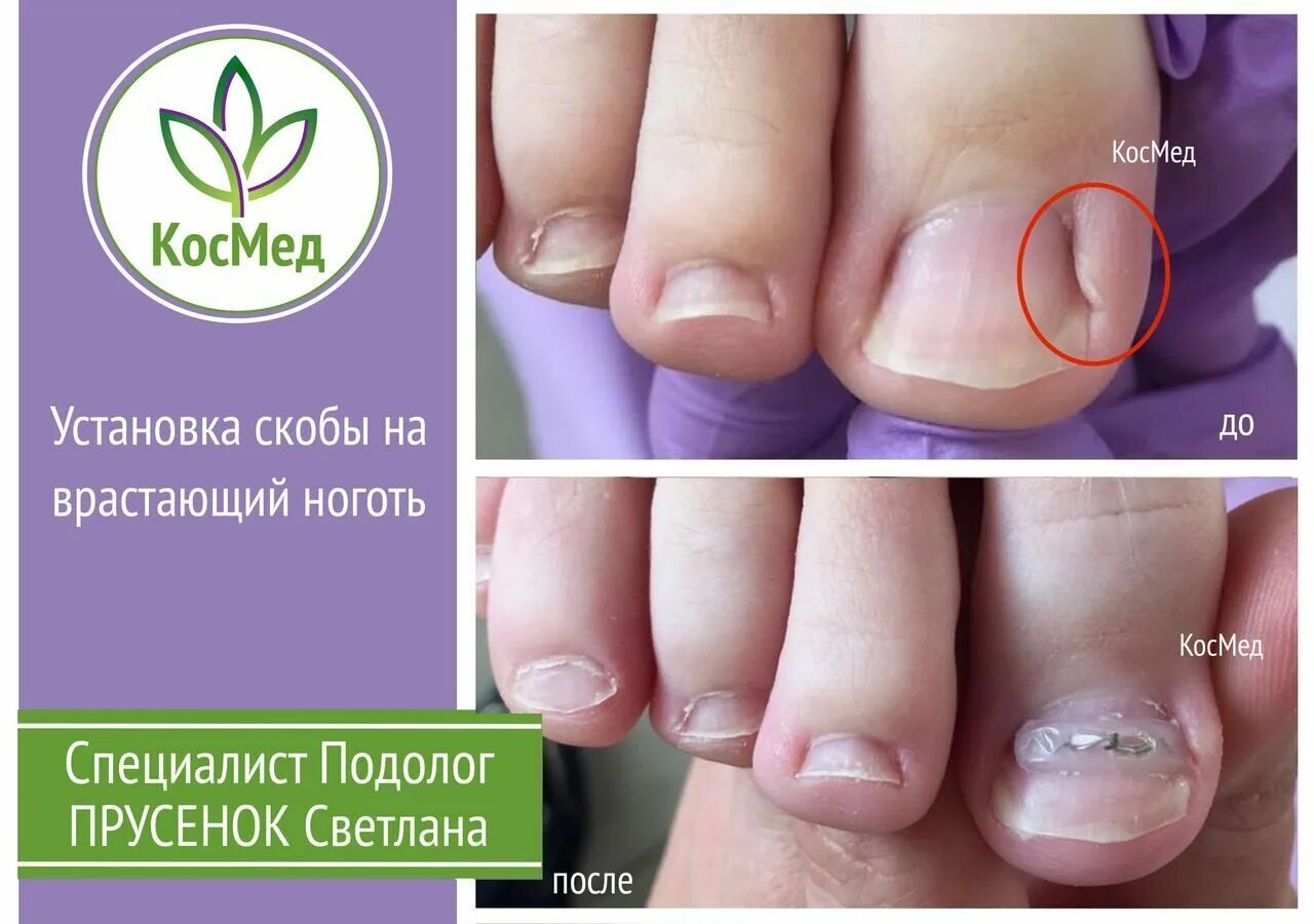 центр подологии евы корнеевой. визитки педикюр подолог. медицинский аппаратный педикюр. подолог ярославль. визитка подолога.