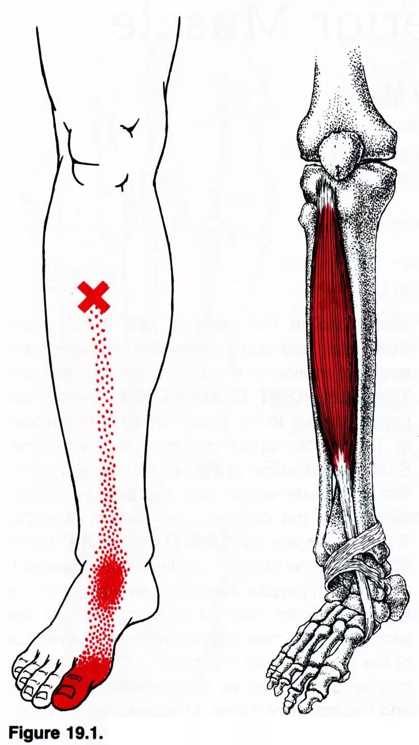 Сильно болят кости. Триггерные точки большеберцовой мышцы. Задняя большеберцовая мышца триггерные точки. Триггерные точки голени. Триггерные точки голеностопного сустава.