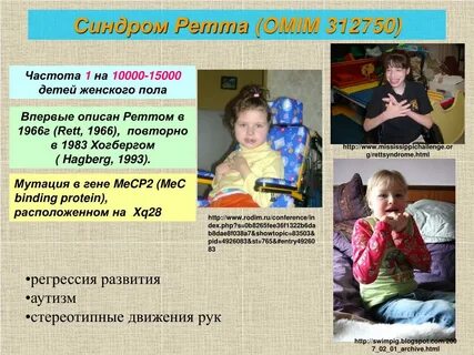 Стереотипные движения