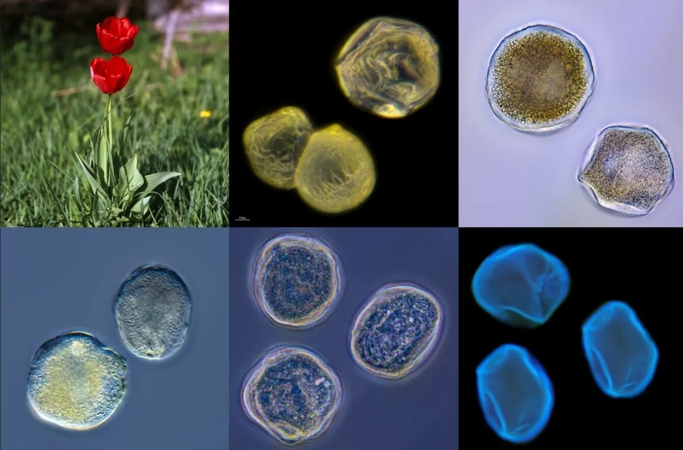 Пыльца растений под микроскопом. Пыльца тюльпана под микроскопом. Пыльца сосны под микроскопом. Пыльца тюльпанапож микроскопам. Как выглядит пыльца