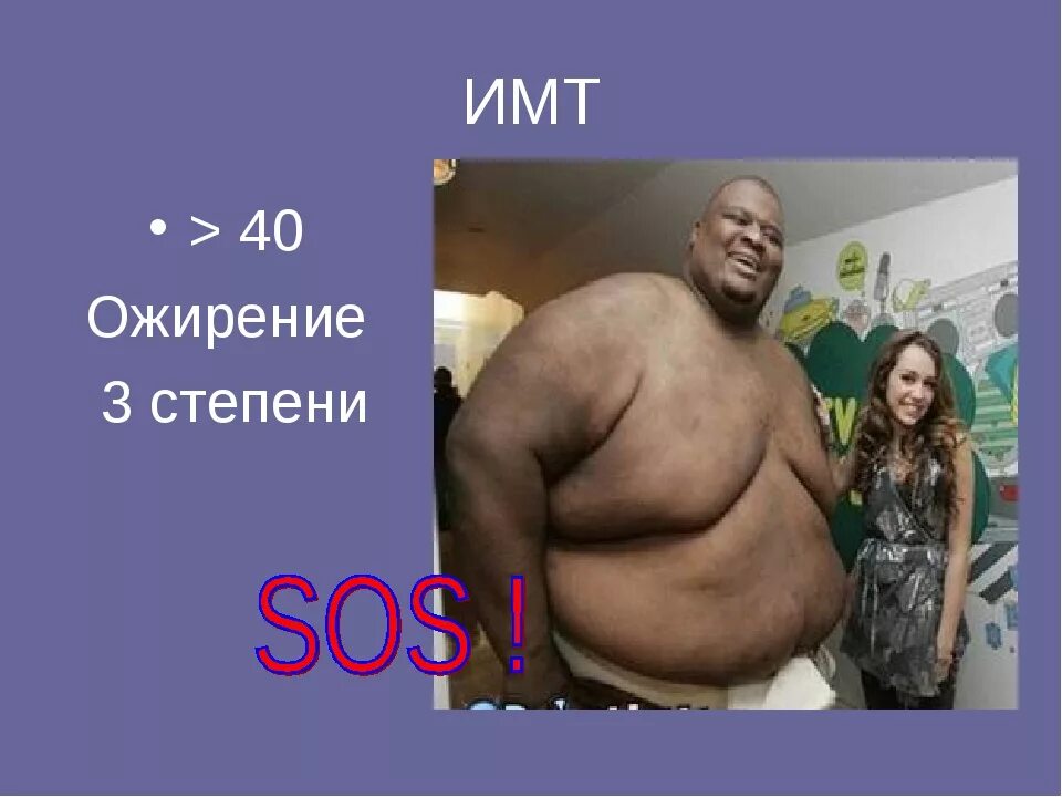 Ожирение 3 степени. Ожирением 3-4 степени. Алиментарное ожирение 2 степени. Ожирение первой степени. Телосложение при ожирении 1 степени.