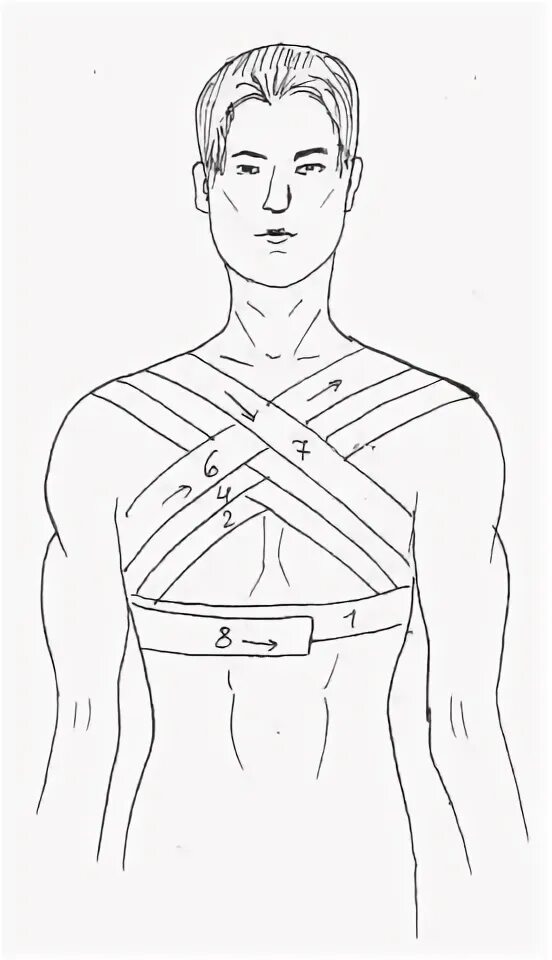 Техника наложения повязок на грудную клетку. Перелом ключицы восьмиобразная повязка. Наложение восьмиобразной повязки на грудную клетку. Крестообразная повязка на грудную клетку алгоритм. Крестообразная (восьмиобразная) повязка.