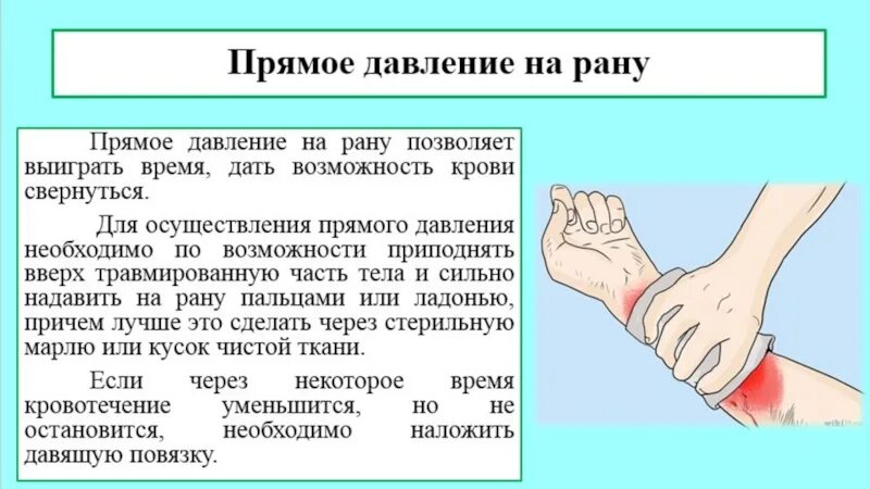 Прямое давление на рану. Прямое давление на рану остановка кровотечений. Прямое давление на рану при кровотечении. 1. Прямое давление на рану.