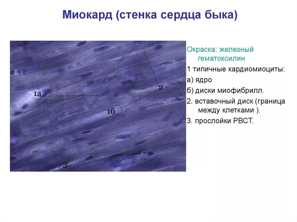 Верховые железа. Сердечная мышечная ткань миокард препарат. Миокард сердце лошади препарат гистология. Миокард препарат гистология Железный гематоксилин. Сердечная мышечная ткань окраска Железный гематоксилин.