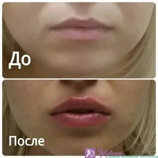 Целоваться после увеличения