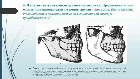 Угол нижней челюсти
