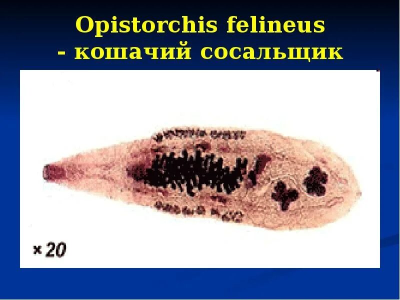Кошачий сосальщик (opisthorchis felineus). Цикл развития opisthorchis felineus. Описторхоз сибирская двуустка. Opisthorchis felineus стадии жизненного цикла. Opistorchis felineus.