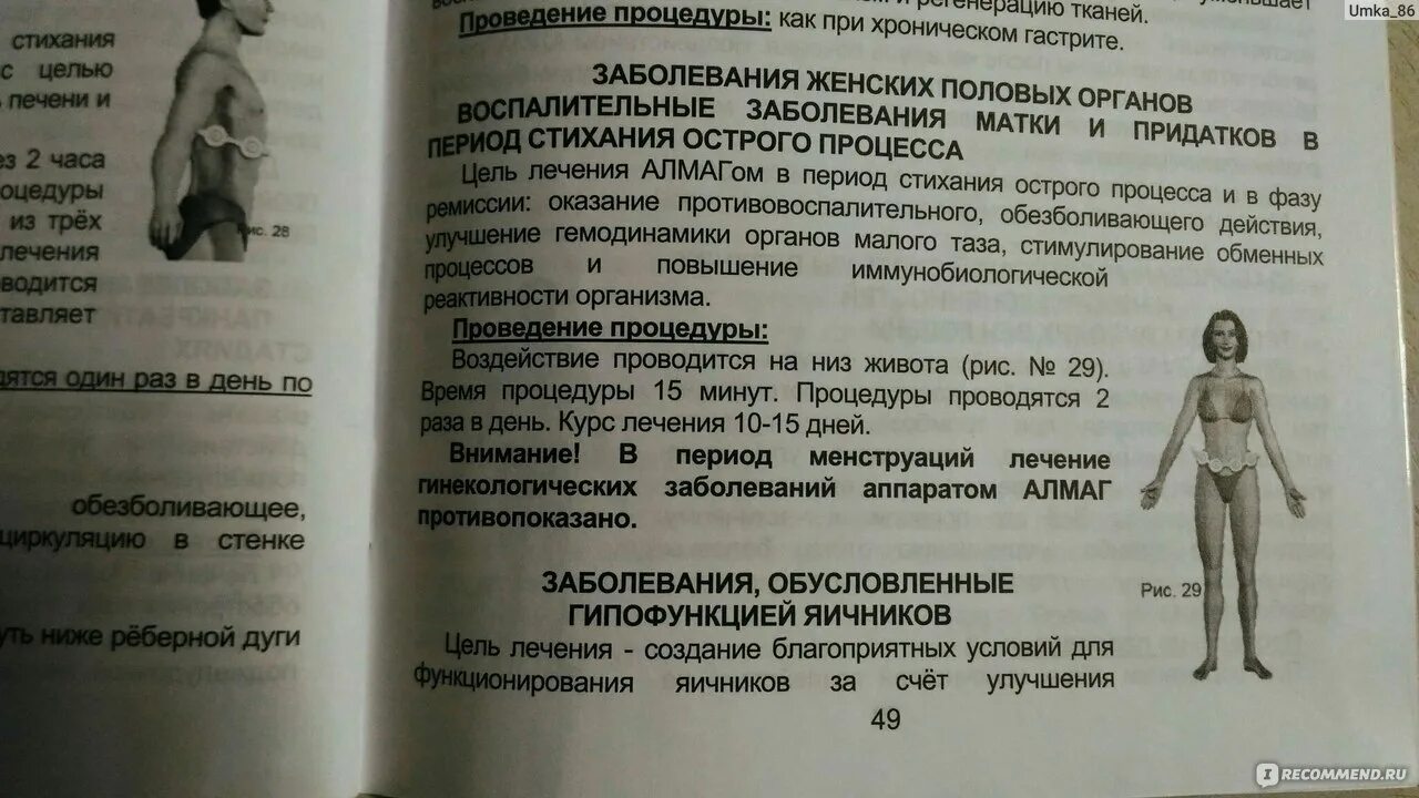 Алмаг инструкция к применению взрослым. Алмаг схемы наложения. Алмаг-01 при гинекологических заболеваниях. Алмаг плюс для коленного сустава. Физиотерапия магнитотерапия алмаг.