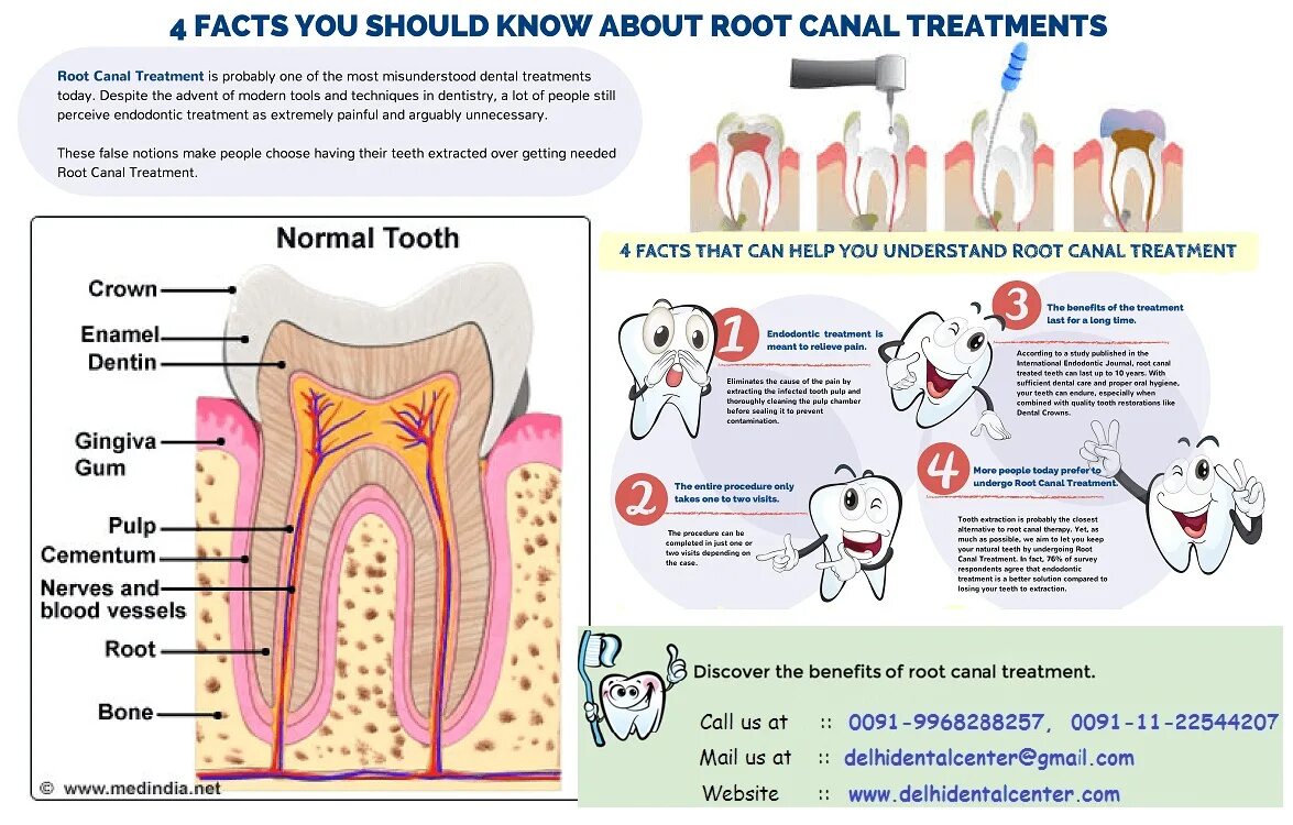 Teeth 5 перевод. Teeth treatment плакат. Teeth перевод.