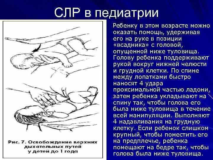 Сердечная реанимация у детей алгоритм. Сердечная реанимация у детей алгоритм