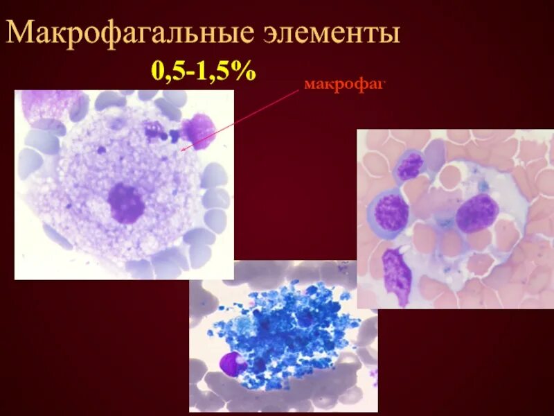 Макрофагальные элементы. Макрофаг. Моноцитарно-макрофагальные. Клетки моноцитарно-макрофагального ряда. Макрофаги количество