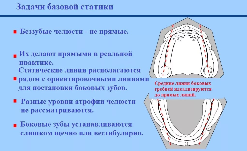 Границы полного съемного протеза верхнего. Границы полного съемного протеза на верхней. границы протеза на верхней челюсти. границы верхнего съемного протеза. границы базиса полного съемного протеза.
