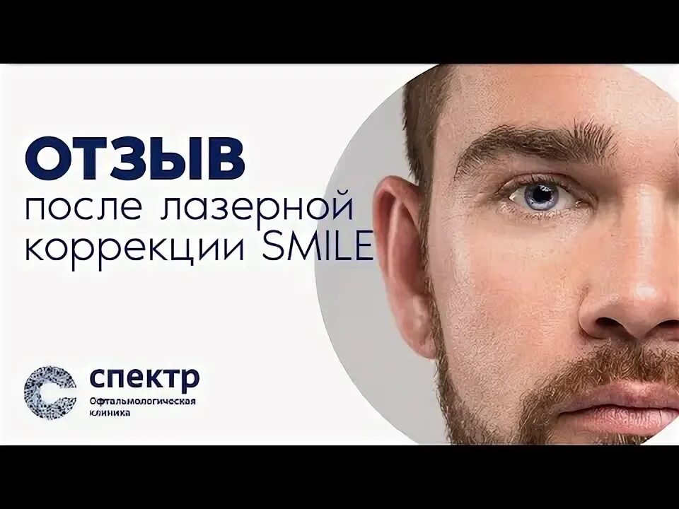 Relex smile clinicaspectr ru