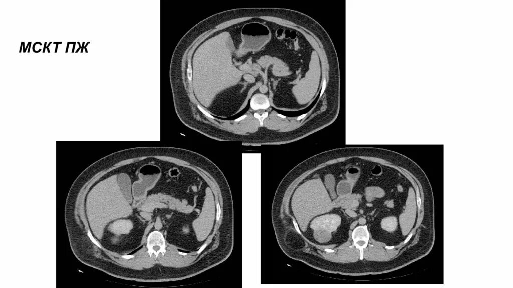 Кт брюшной полости облучение. Кт органов брюшной полости. Основа изображения органов на кт. Н 3 кт