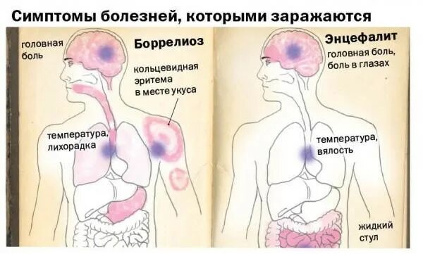 Боррелиоз распространение. Берлиоз болезнь признаки. Инкубационный период боррелиоза. Иксодовый клещевой боррелиоз диагностика. Берлиоз болезнь признаки.