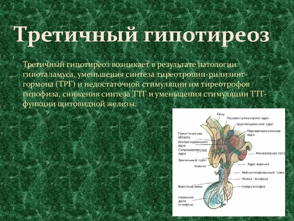 Типы гипотиреоза. Первичный вторичный третичный гипотиреоз. Гипоталамо-гипофизарный гипотиреоз. Гипотиреоз презентация. Причины третичного гипотиреоза.