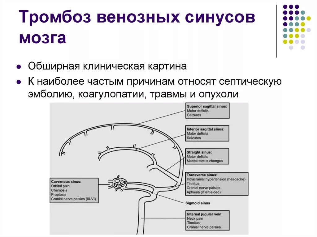 Тромбоз верхнего сагиттального синуса. Тромбоз сагиттального синуса головного мозга. Тромбоз сагиттального синуса на кт. Тромбоз поперечного синуса клиническая картина. Тромбоз мозговых сосудов