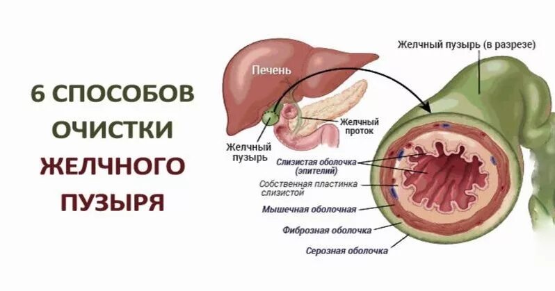 Желчный пузырь лечение народными средствами в домашних. Слизистая оболочка желчного пузыря. Лечение желчного пузыря. Как вылечить желчный пузырь. Желчный пузырь в разрезе.