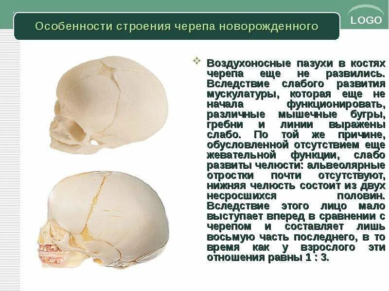 Афо черепа новорожденного. Строение свода черепа новорожденного. Особенности строения костей свода черепа у детей. Кости свода черепа строение. Чем можно объяснить легкость черепа