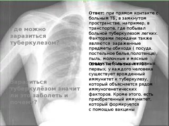 Если съесть собаку не заболеть туберкулезом. Туберкулёз как можно заразиться. Риск заражения туберкулезом. Как не заразиться туберкулезом при контакте с больным. Как можно заболеть туберкулезом.