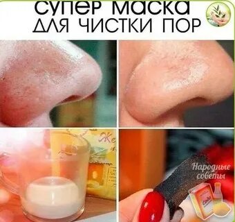 Очистка пор