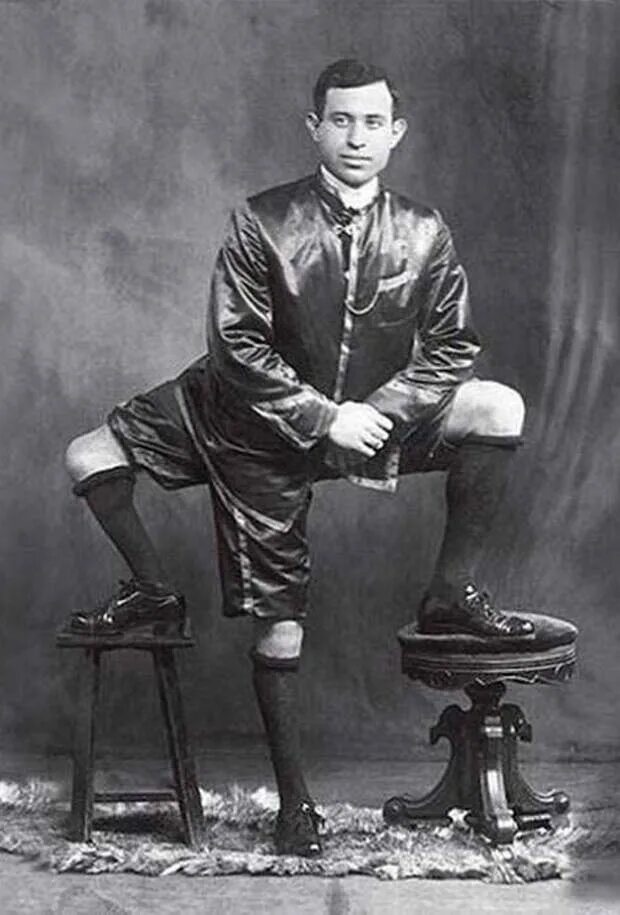 Видит три ноги. Франческо Лентини. Фрэнк Лентини человек. Франческо Лентини человек с тремя ногами. Фрэнк Лентини фото.