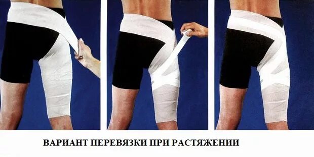 Растяжение передней. Эластичный бинт при растяжении передних мышц бедра. растяжение бедренной мышцы.