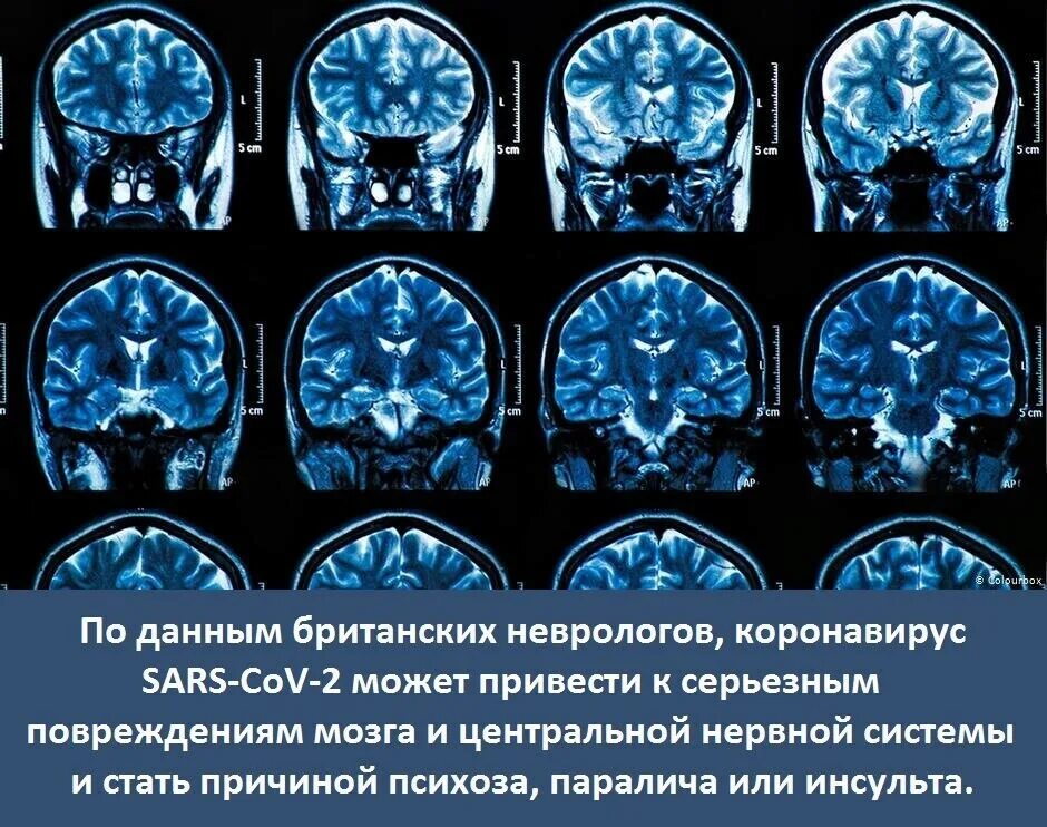 После мрт головного мозга. После мрт головного мозга