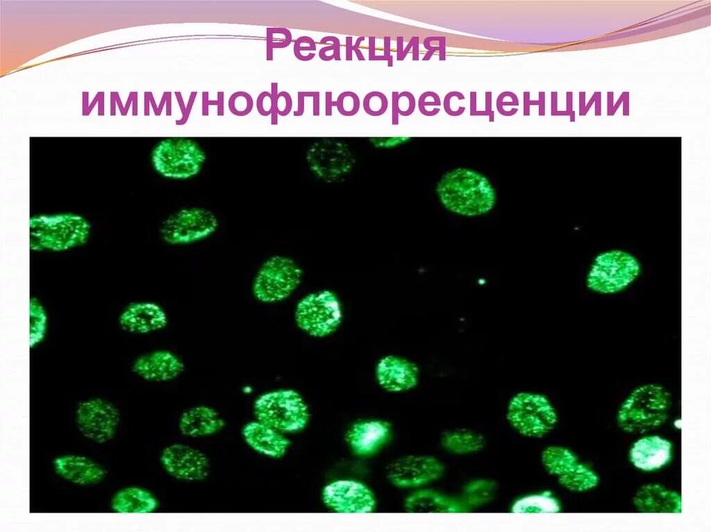 Риф реакция. Реакции непрямой иммунофлюоресценции (риф). реакция иммунофлюоресценции (риф) (метод кунса). риф реакция иммунофлюоресценции. компоненты непрямой реакции иммунофлюоресценции.