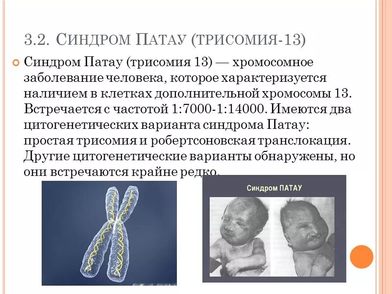 Хромосомные мутации методы генетики. Синдром Патау трисомия по 13 хромосоме. Хромосомные болезни Патау. Синдром Патау (трисомия 13-й хромосомы). Синдром Дауна (трисомия по 21 паре хромосом).