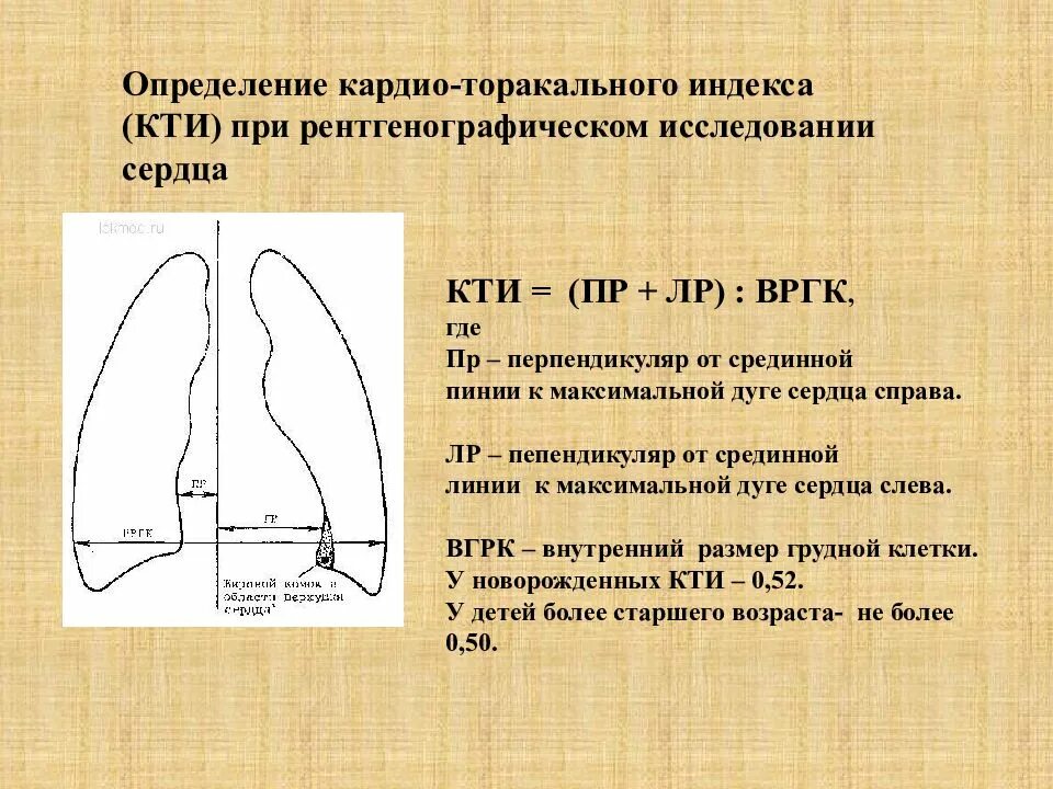 Карлио тракальный рдекс. КТИ норма в рентгене. Кардио то Оракальный индекс. Кардиоторакальный Инекс. Длинник и поперечник