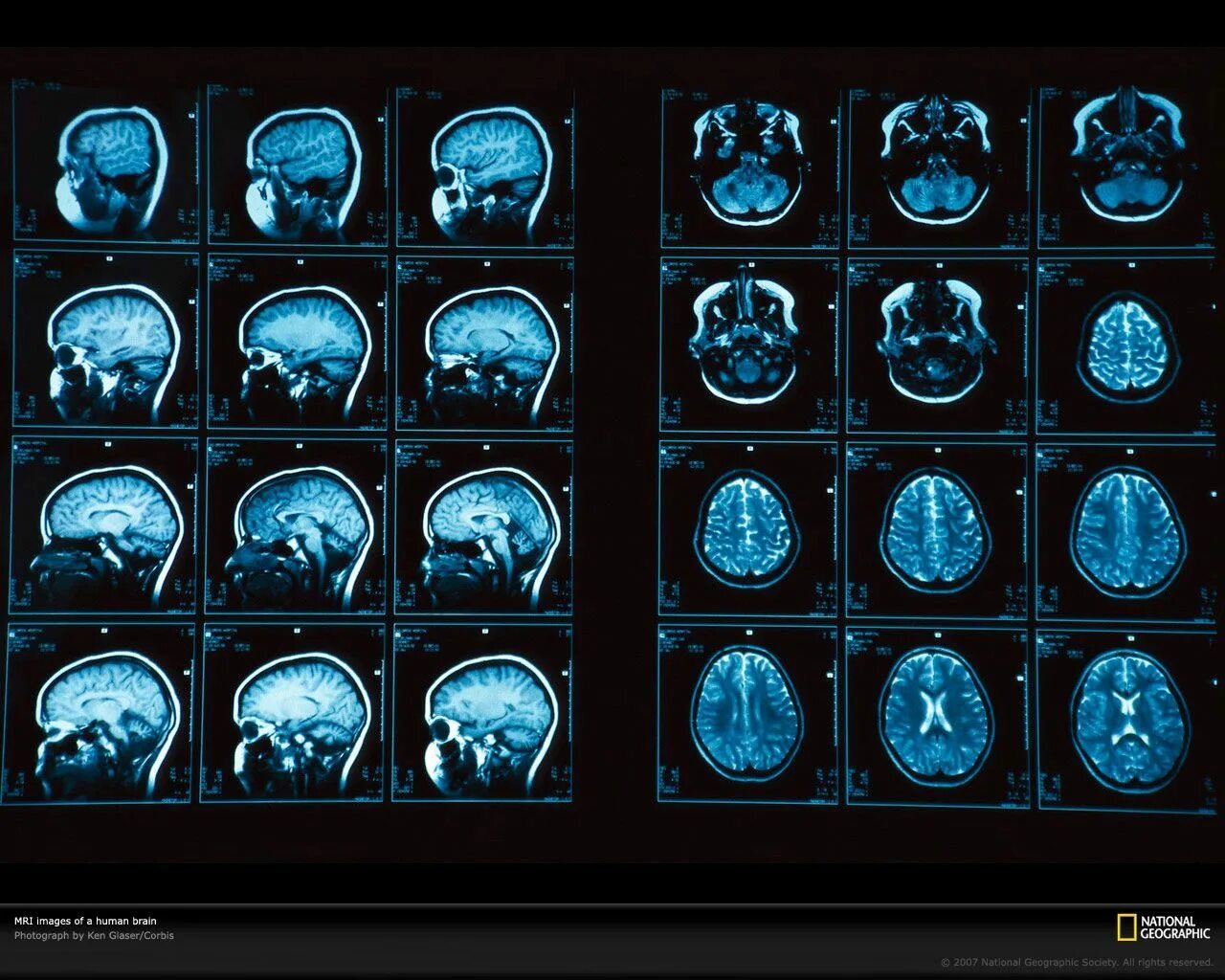 Кт томограмма головного мозга. Магнитно-резонансная томография мрт снимки. Компьютерная томография кт головного мозга. Магнито-резонансная томография головного мозга.