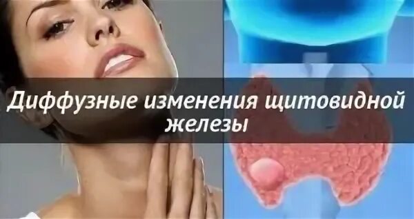 Диффузные изменения это опасно. Диффузные изменения щитовидной железы. диффузионные изменения щитовидной железы. диффузные изменения щж. диффузно-узловые изменения щитовидной железы что это.