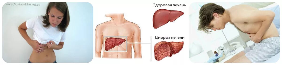 Боли в стороне печени