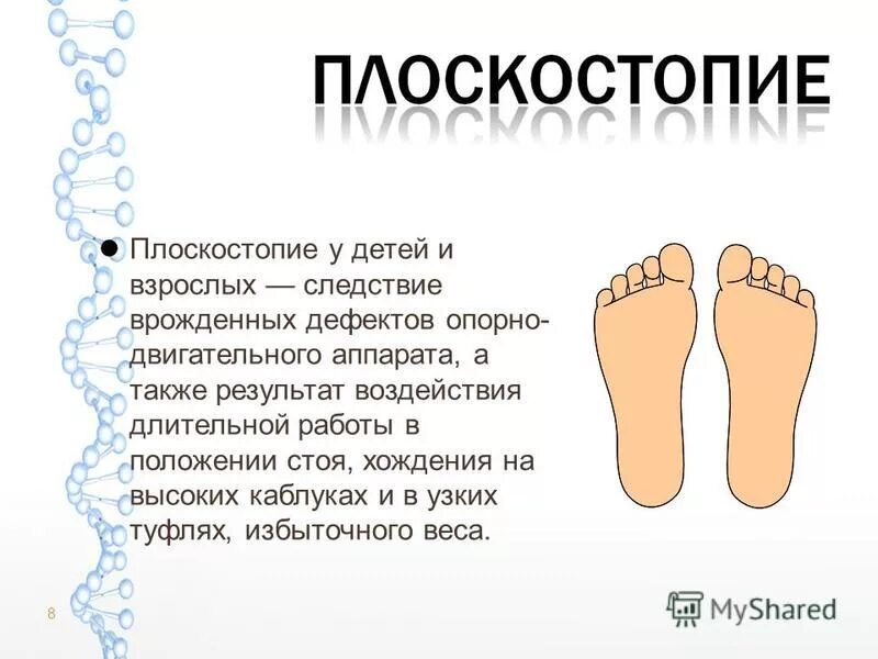 стопа с 1 степенью плоскостопия. степени развития плоскостопия. плоскостопие у детей. как определить плоскостопие у ребенка год. плантограмма стопы у детей.