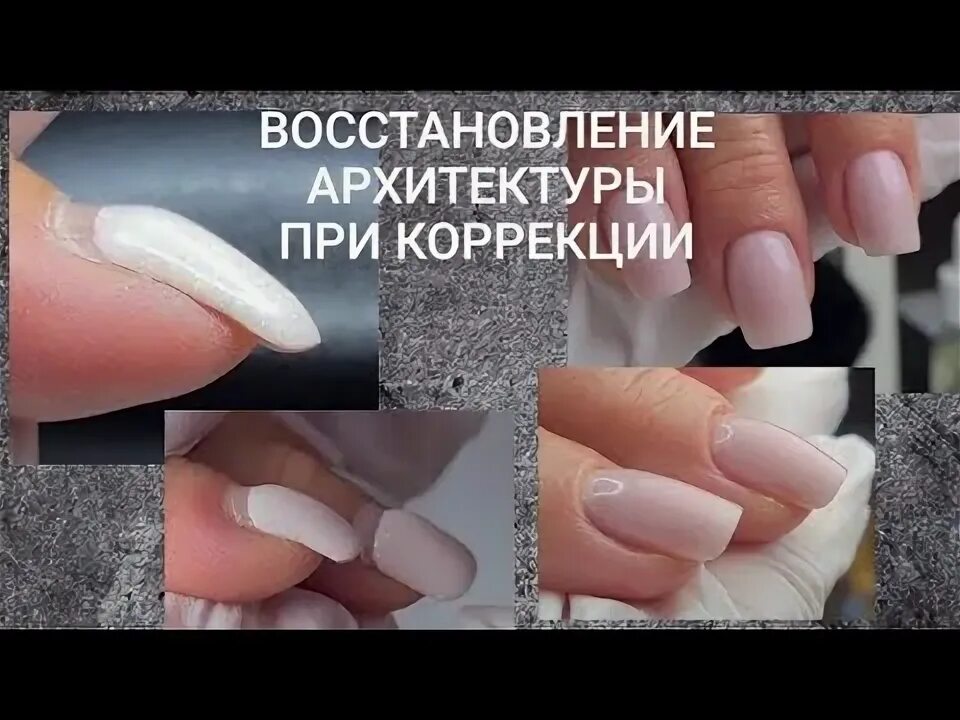 Правильная форма нарощенного ногтя. Архитектура ногтя гелем. Восстановление архитектуры ногтя. Правильная архитектура ногтя при наращивании. Формы для моделирования ногтей.